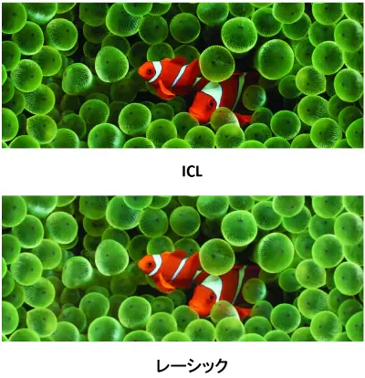 図5 ICLとレーシックのコントラスト感度の違い